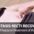 Diastasis Recti treatment and recovery