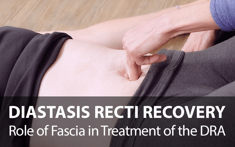 Diastasis Recti Awareness – Role of Fascia in Treatment of the